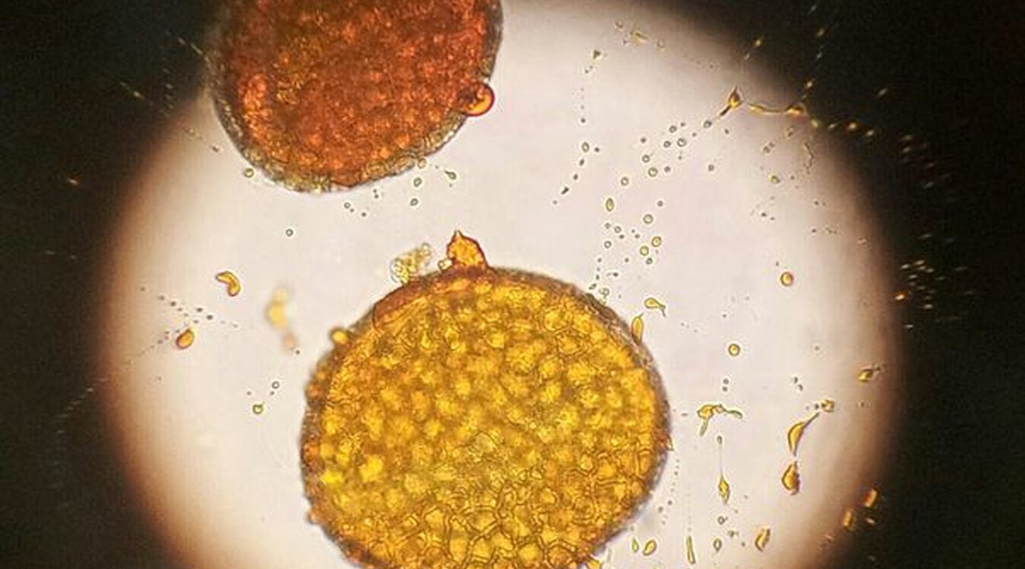 Stuifmeelkorrels/pollen onder de microscoop