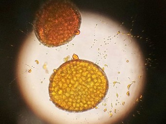 Stuifmeelkorrels/pollen onder de microscoop