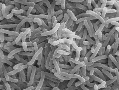 Bacterien onder de electronenmicroscoop.