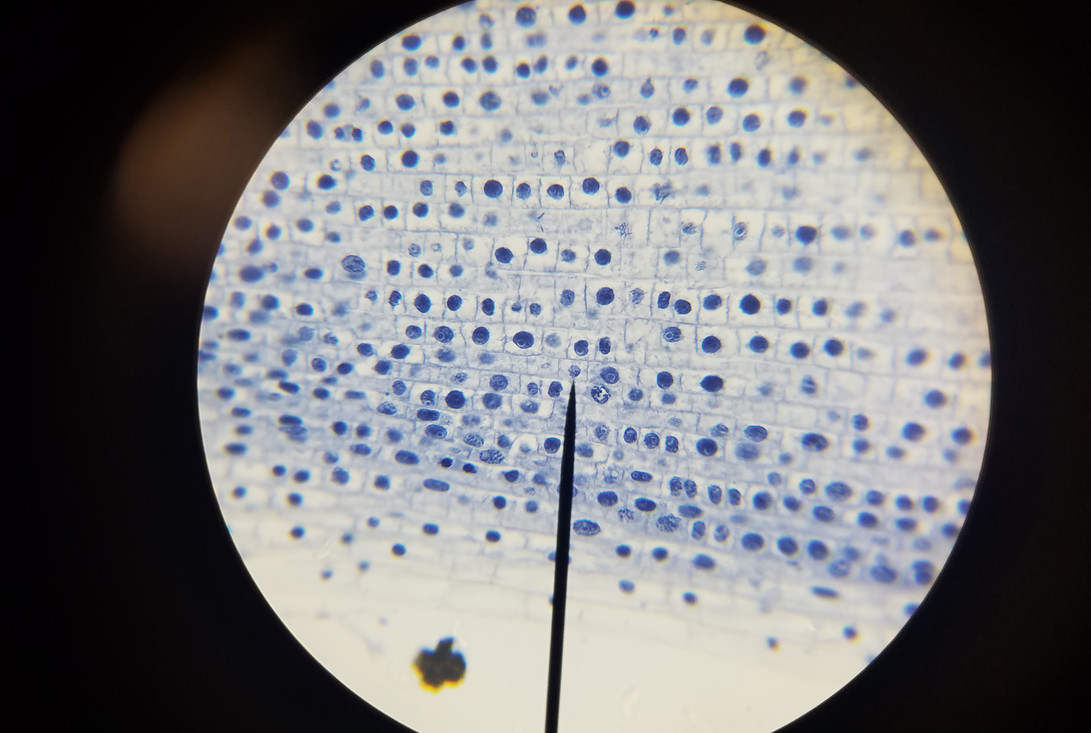 Het beeld door een microscoop: hier zijn de cellen van een ui vergroot. 