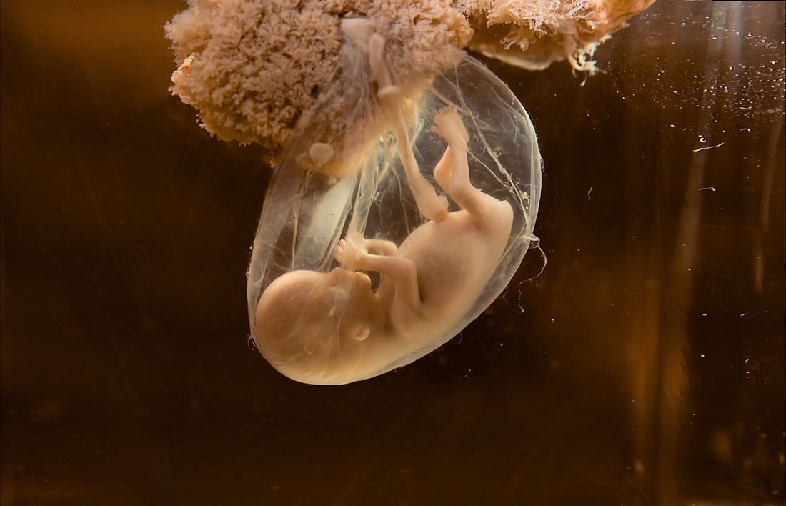 In dit model van een embryo zie je de navelstreng goed.