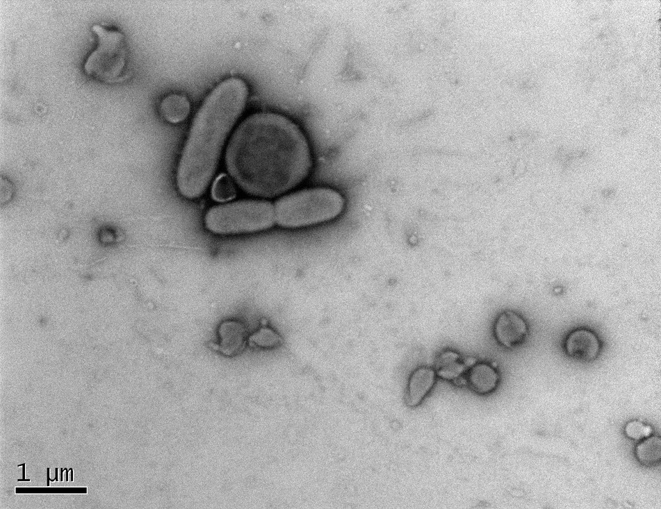 Archaea worden in het lab onder een microscoop bekeken. Hier zijn de archaea Ca. Nha. antarcticus en Halorubrum lacusprofundi te zien.