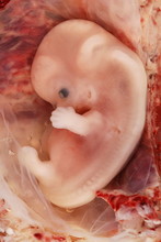 Een ongeboren baby
