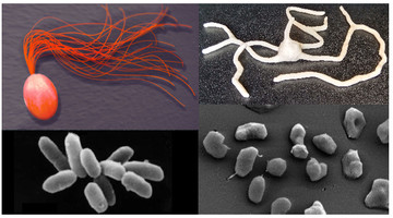 Archaea hebben verschillende vormen, hier zijn deze te zien onder een microscoop